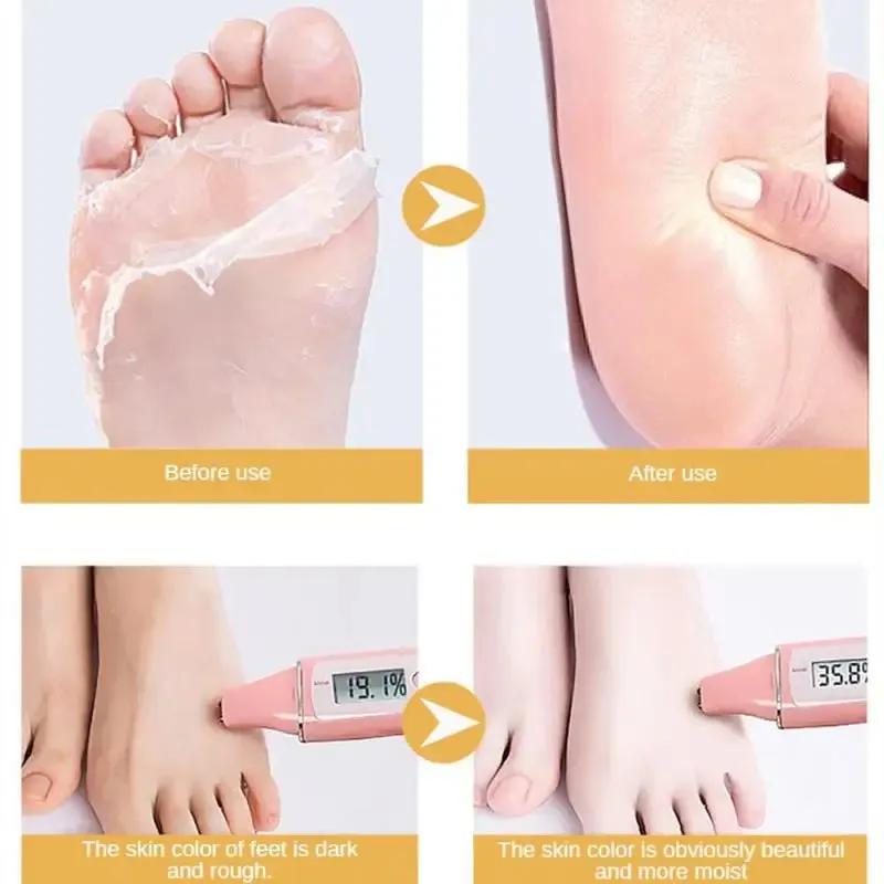 10 Pairs Nicotinamide Goat Milk Moisturizing Exfoliating Nourishing Hand & Foot Masks