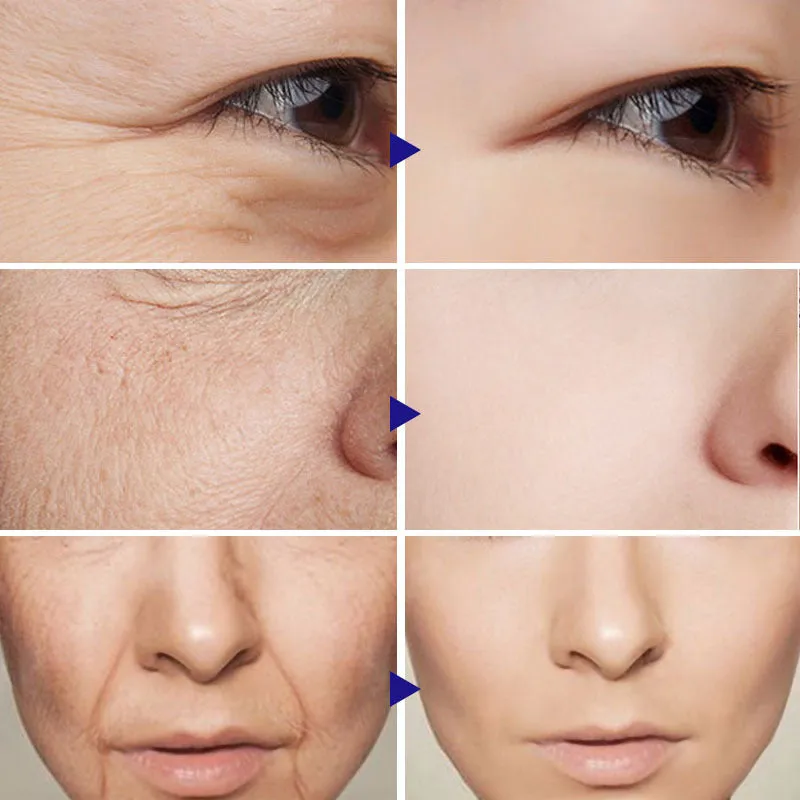 Vitamin C Serum Facial Serum – Hydrating & Moisturizing Essential Oil